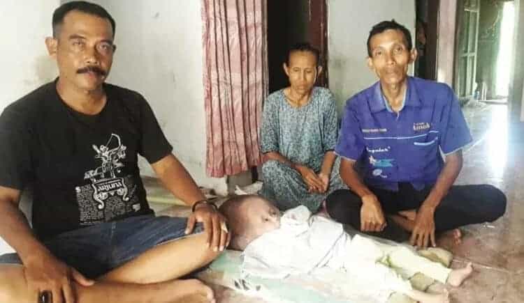 Bayi Mengidap Hidrosefalus, Butuhkan Bantuan