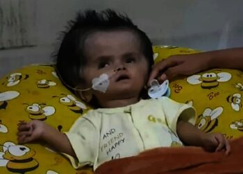 Bayi Laki-Laki Usia 1 Tahun Idap Penyakit Hydrocephalus