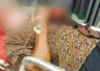 Tukang Rujak di Kresek Tangerang Dibacok Hingga Kritis
