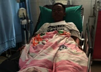 Pemuda Difabel Diduga Dicekoki Miras Hingga Badannya Melepuh