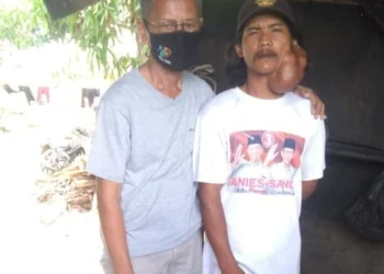 Arsali Empat Tahun Menunggu Kamar Kosong di RSU Tangerang