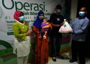 Peringati Hari Anak RS Sari Asih Serang Operasi Gratis Bibir Sumbing