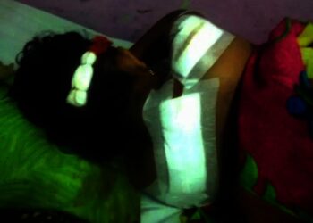 TERBARING–Korban pembacokan suaminya sendiri, sedang berbaring menahan rasa sakit luka yang dideritanya, Senin (6/12/2021). (ISTIMEWA)
