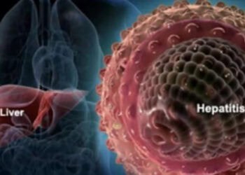 penyakit-hepatitis-akut-misterius-hasil-investigasi-sementara-kemenkes-semua-pasien-telat-ditangani-1-anak-belum-divaksin-hepatitis_123284