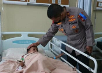 MENJENGUK PASIEN–Kapolda Banten Irjen Pol Prof. Dr. Rudy Heriyanto, menjenguk pasien penderita bibir sumbing, usai dioperasi di RS Bhayangkara Polda Banten, Senin (13/6/2022). (ISTIMEWA)