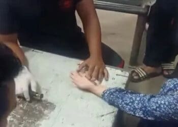 Cincin Tak Bisa Dilepas hingga Jari Bengkak, Warga Minta Bantuan BPBD Kota Tangerang