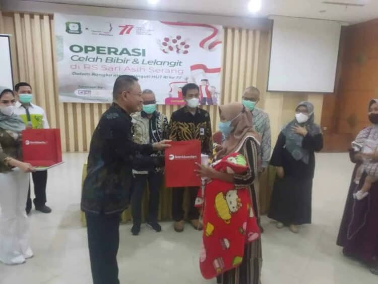 Bank Banten dan RS Sari Asih, kolaborasi tangani penderita bibir sumbing, Kamis (LUTHFI/SATELITNEWS.ID)