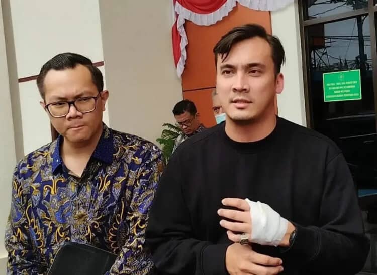 Rendy Kjaernett Ungkap Kronologi Kecelakaan di Tol Bareng Lady Nayoan