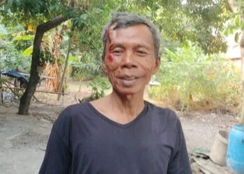 Baliho Bergambar Sachrudin-Airin Timpa Pengendara Motor, Korban Luka di Pelipis