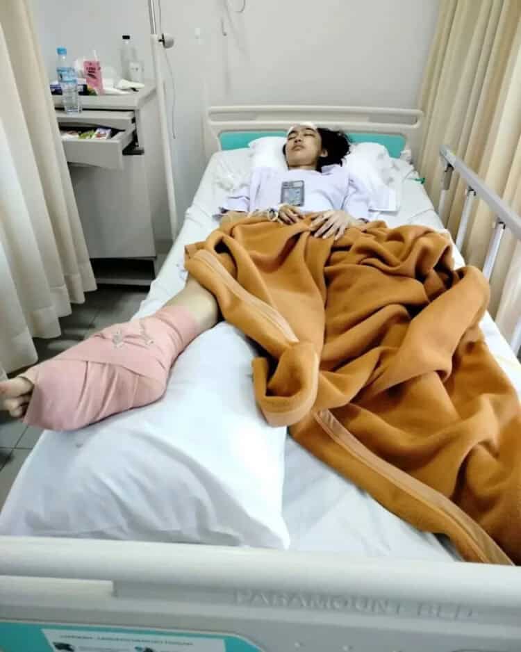 Salah Satu Korban Sopir Truk Ugal-ugalan Diprediksi Cacat Tampilan
