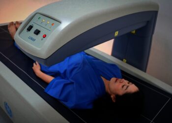 Waspadai Osteoporosis, Deteksi Dini Risiko Patah Tulang dengan Bone Mineral Densitometry