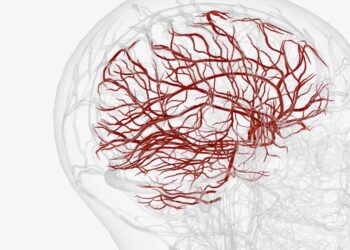 Digital Subtraction Angiography, Bantu Dokter Deteksi Jalur Macet di Pembuluh Darah Otak