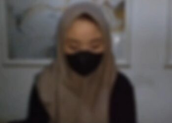 Korban perilaku kekerasan sang kekasih, berinisial B. (ISTIMEWA)