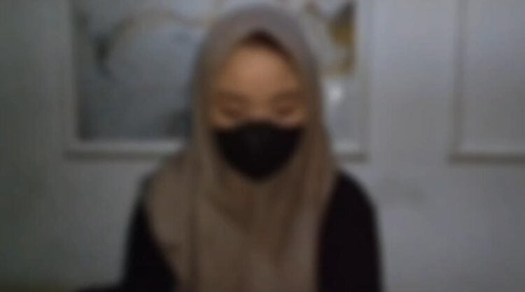 Korban perilaku kekerasan sang kekasih, berinisial B. (ISTIMEWA)