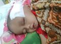 DI BIOPSI – Farhan (3) penderita tumor ganas dibagian wajah, usai biopsi, di RS Dharmais, Jakarta, Rabu (3/6/2026). (ISTIMEWA)