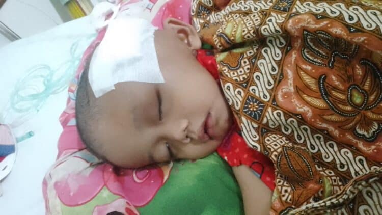 DI BIOPSI - Farhan (3) penderita tumor ganas dibagian wajah, usai biopsi, di RS Dharmais, Jakarta, Rabu (3/6/2026). (ISTIMEWA)