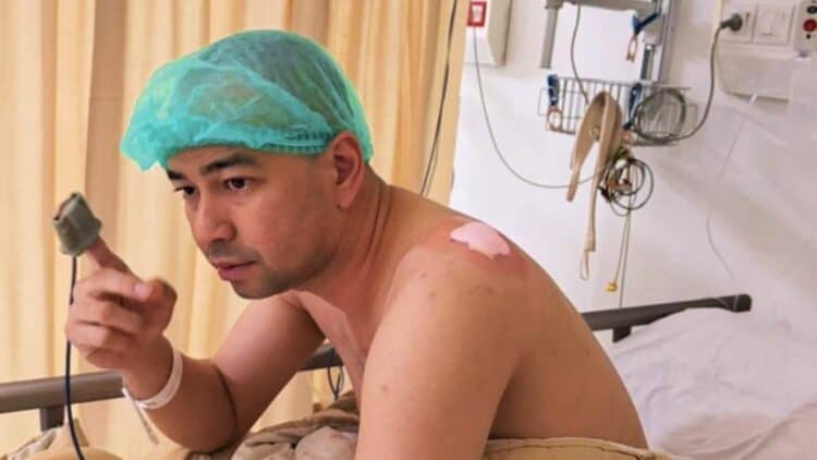 Kondisi Raffi Ahmad Usai Jalani Operasi Lipoma