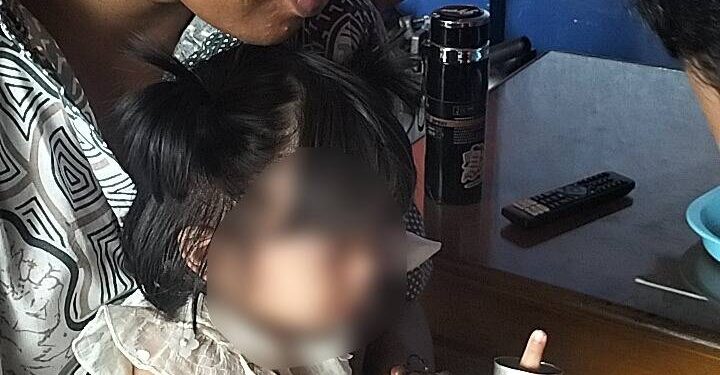 Ikuti Hadir di Hajatan, Jari Balita di Ciledug Tersangkut Seng
