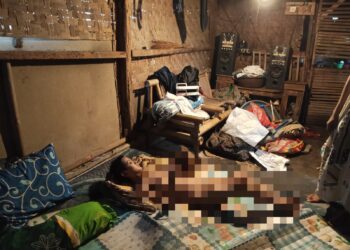 BERBARING - Siti Lutfiah (19), warga Kampung Kubang, Desa Mekarwangi, Kecamatan Saketi, Kabupaten Pandeglang, hanya bisa berbaring diatas kasur di rumahnya, dengan segala keterbatasan yang dialaminya. (ISTIMEWA)